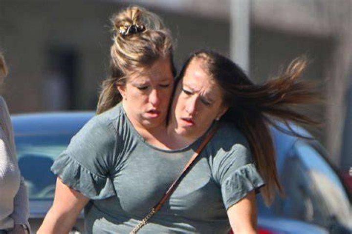 Abby Hensel Net Worth, Age, Height, Bio A Complete Insight Tamys