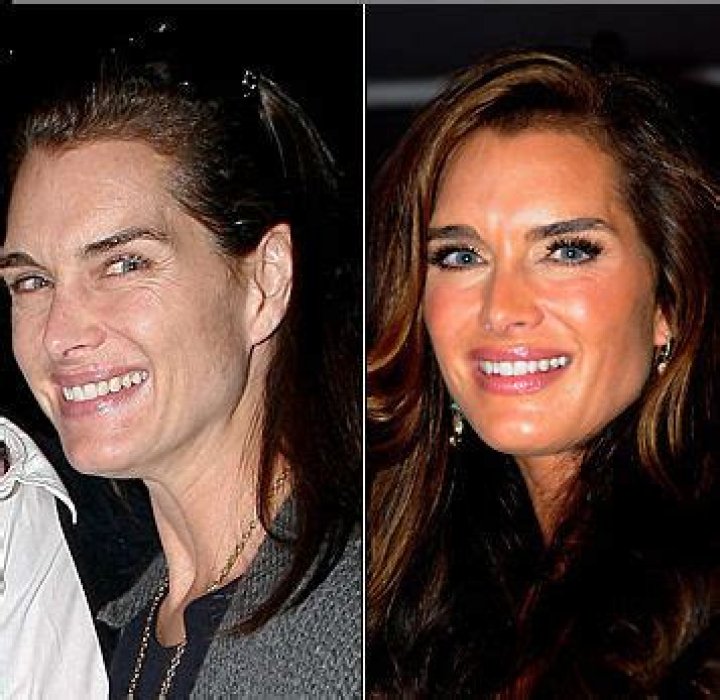 Brooke Shields Face Lift Did She Get Botox Or Her Nose Done?