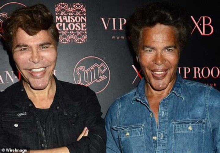 French TV star twins die with Covid just days apart