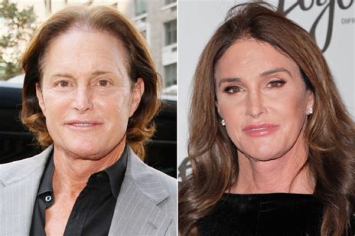 Unveiling The Truth: Caitlyn Jenner's Transgender Journey