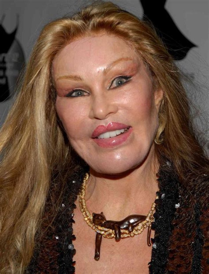 Who is Jocelyn Wildenstein, what did she look like when she was young